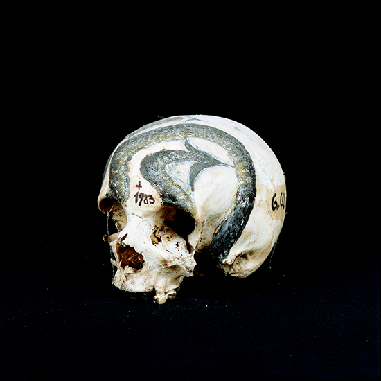 Kopf008